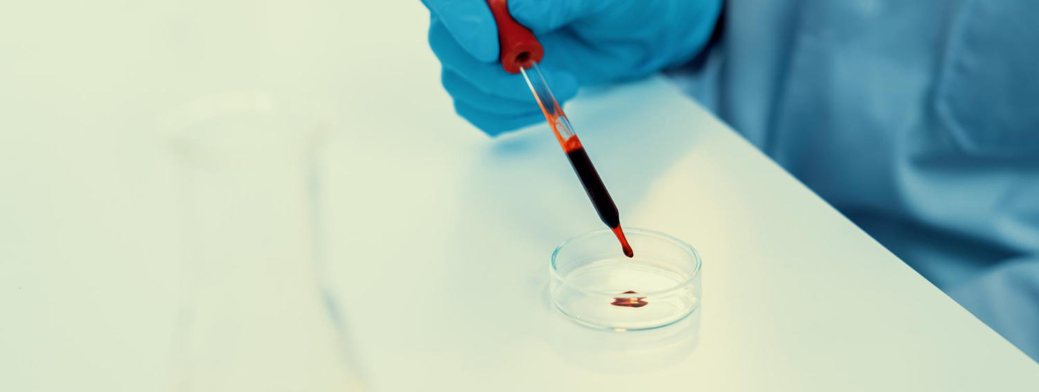 HEMATURIA 1