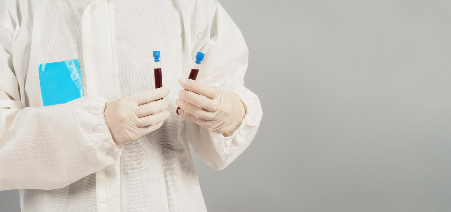 HEMATURIA 2